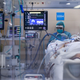 The covid-19 pandemic has been a tragic reminder of the limits of respiratory technologies.